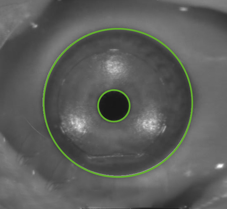 [Translate to Chinesisch:] Close-up eye
